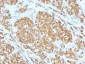  MART-1 / Melan-A / MLANA (Melanoma Marker) Antibody - With BSA and Azide